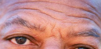 10 Habits that Cause Wrinkles Wrinkled Man Face